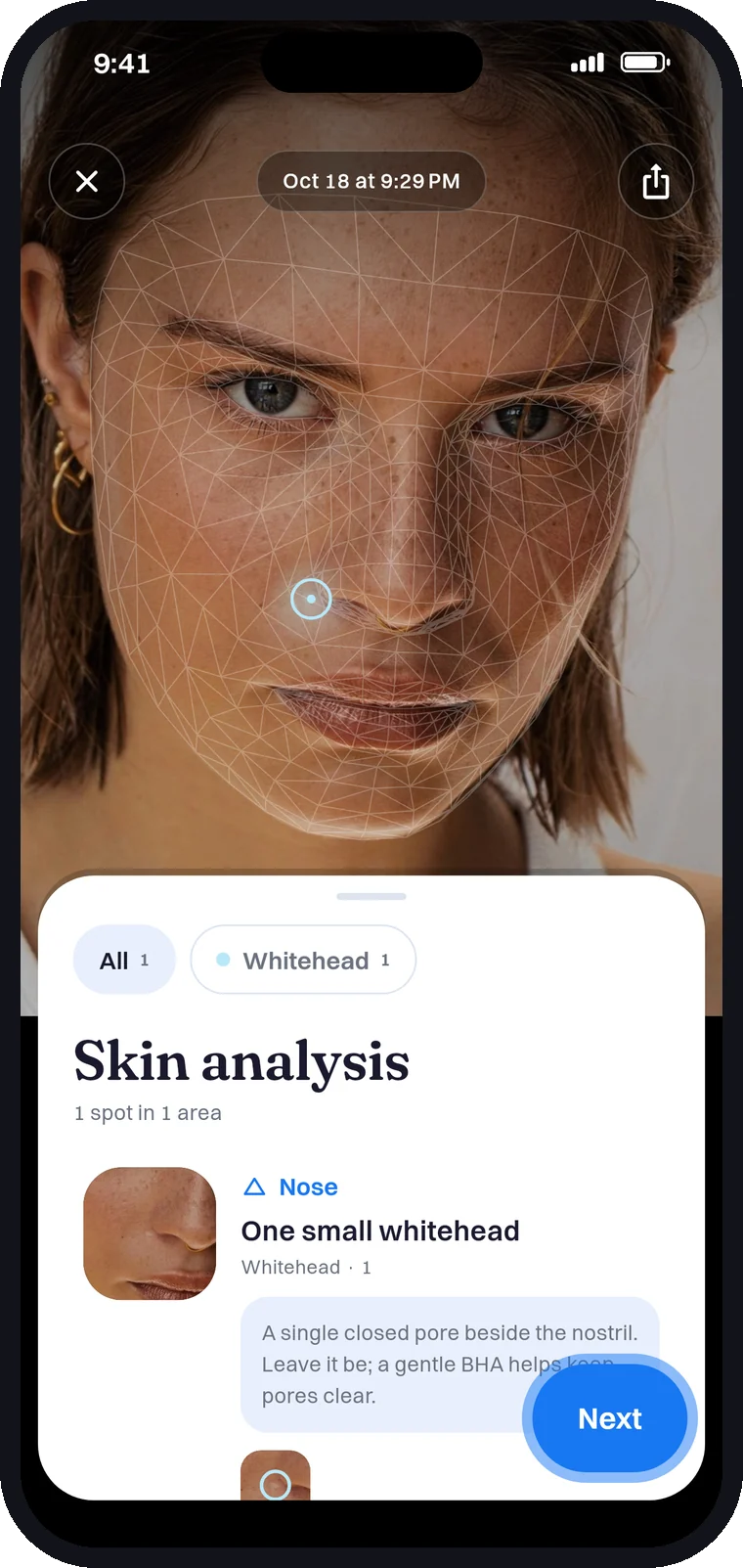 Dermaglow scan result: a face mapped with one spot marked